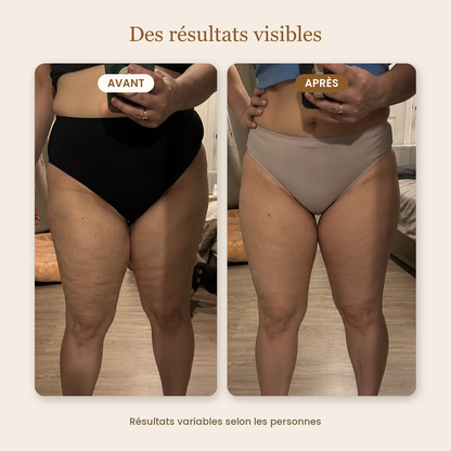 Avant / après